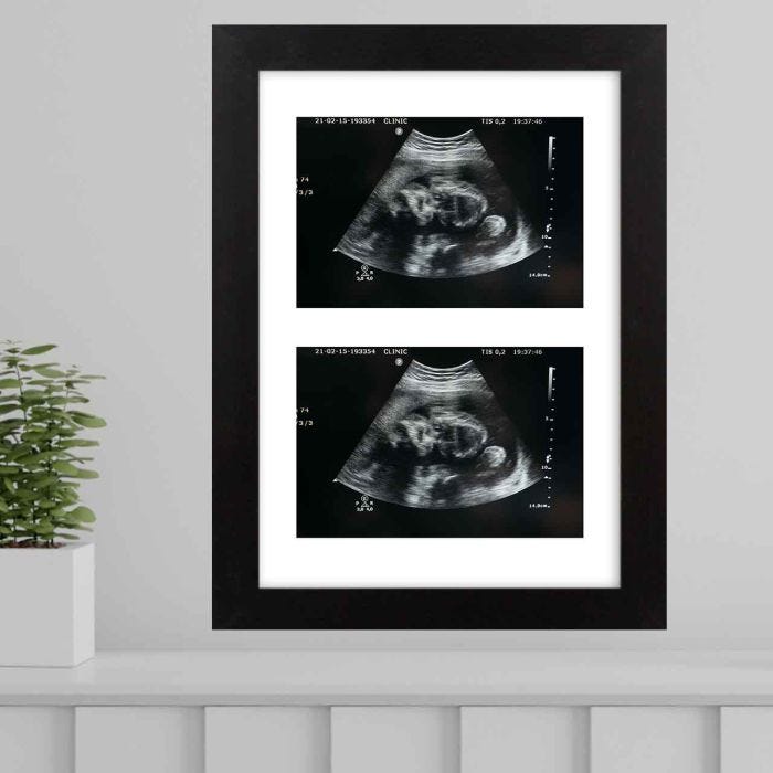 Baby Scan 2 Image Print & Frame Cheltenham Snappy Snaps